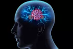 COVID reduce la materia gris del cerebro