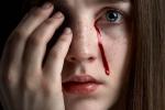 Hemolacria, por qué es posible llorar sangre