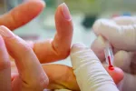 Descubren cómo diagnosticar la miocarditis con una gota de sangre Avance diagnóstico para la miocarditis