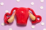 Los fármacos para la fertilidad no elevan el riesgo de cáncer de mama Terapias de fertilidad no causan cáncer