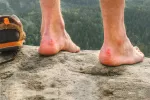 Ampollas Ampollas, cómo actuar