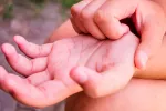 Vinculan el MIS-C pos-COVID en niños al debilitamiento de células T Niño rascándose las muñecas de la mano