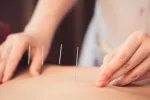 Hallan neuronas clave en la respuesta antiinflamatoria de la acupuntura Acupuntura ¿por qué es antiinflamatoria?