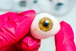 Ojo impreso en 3D implantado por 1ª vez