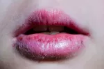 El virus de la enfermedad del beso podría causar esclerosis múltiple Virus Epstein-Bar causa de esclerosis