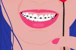 Qué comer con brackets y qué alimentos evitar Qué comer con brackets