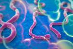 Virus ébola persiste en el cerebro