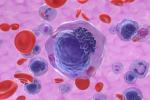 Gen en la sangre con leucemia linfocítica crónica