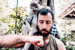 Hombre siendo contagiado por la viruela del mono
