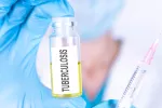 Una vacuna española contra la tuberculosis, eficaz en cáncer de vejiga Vacuna española eficaz en tumor de vejiga