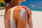 Protección frente al sol, claves para evitar que dañe tu piel Protección frente al sol