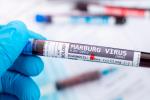 Virus de Marburgo: test positivo