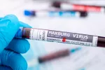 Primer brote de la enfermedad del virus de Marburgo en Ghana Virus de Marburgo: test positivo