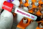 Test del virus monkeypox