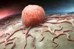 Célula cancerosa extendiéndose por el cuerpo Descubren cómo se propagan las metástasis por el organismo