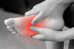 Pie afectado por Neuroma de Morton Neuroma de Morton, opciones para tratarlo con efectividad