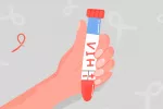 Combinar inmunoterapia y antirretrovirales ayudaría a eliminar el VIH VIH: nueva estrategia para eliminarlo