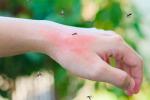 Mosquitos picando en la mano a una persona
