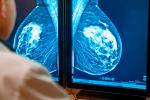 Médico analizando una mamografía