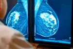 Descubren cómo frenar el desencadenante del cáncer de mama metastásico Médico analizando una mamografía