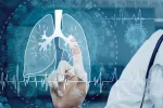 Hallan cómo saber si un tratamiento para cáncer de pulmón es eficaz Infografía de un pulmón