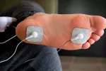 La estimulación eléctrica cura heridas crónicas tres veces más rápido Persona diabética recibiendo tratamiento por estimulación eléctrica en las heridas del pié