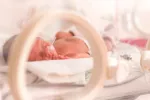 Emergencia: uno de cada 10 bebés que nacen en el mundo es prematuro Bebé prematuro en la incubadora