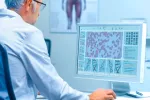 Revelan una conexión genética entre celiaquía y un agresivo tumor raro Médico de laboratorio trabajando con pruebas