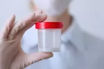La calidad del semen disminuye a largo plazo tras padecer COVID leve Doctor con una muestra de semen