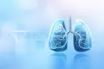 Nuevo tratamiento mejora la supervivencia de pacientes con cáncer del pulmón Avance en el tratamiento del cáncer de pulmón