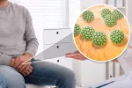 Virus del papiloma humano genital Hombre en la consulta afectado por el virus del papiloma humano genital