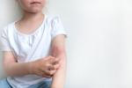 Niña se rasca las erupciones en el brazo por dermatitis atópica
