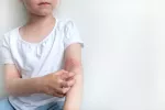 Piel seca por dermatitis atópica Niña se rasca las erupciones en el brazo por dermatitis atópica
