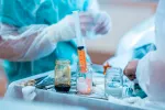 Un trasplante de células madre podría frenar la esclerosis múltiple Trasplante de células madre