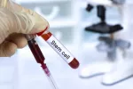 Células madre prenatales muestran potencial para curar la hemofilia A Muestra de células madre para analizar en el laboratorio
