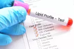 Identifican un tipo de lípido que puede ayudar a tratar la diabetes Muestra de sangre para una prueba de perfil lipídico