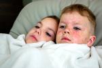 Dos hermanos contagiados con el virus del sarampión