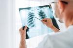 Doctor observando una radiografía de pulmón