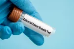 Test de sangre detecta cáncer de colon en su inicio con un 83% de eficacia Un médico recogiendo una muestra de sangre