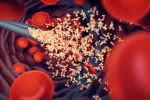 Una vacuna de ARNm programa el sistema inmune para atacar el cáncer cerebral Inyección de la vacuna de RNAm