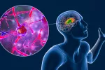 Un fármaco para la lepra podría ser útil en la enfermedad de Huntington Visión de cerca de la degradación neuronal, ilustración 3D conceptual