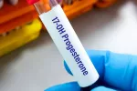 Recomiendan retirar un fármaco para embarazadas por riesgo de cáncer Científico llevando una muestra de sangre para la prueba de 17-OHPC