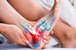 La terapia con plasma de helio acelera la curación del tendón de Aquiles Tobillo con el tendón de Aquiles inflamado