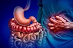 Crohn y colitis ulcerosa: hallan la causa cardinal de EII y cómo tratarla Ilustración del intestino humano