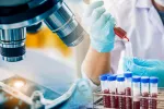 Un test de sangre basado en IA detecta párkinson con 7 años de antelación Científico analizando unas muestras de sangre en el laboratorio