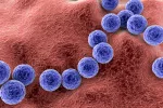 Bacteria ‘carnívora’, cómo se contagia y cuáles son sus riesgos Streptococcus pyogenes