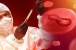 Brote de viruela del mono sin precedentes en 15 países de África Sanitario sostiene tubo con muestra de sangre infectada por mpox