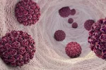 La fertilidad de los hombres infectados con VPH de alto riesgo peligra Virus del papiloma humano (VPH)