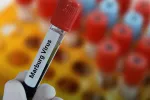 La OMS alerta de un brote del peligroso virus de Marburgo similar al ébola Muestra de sangre infectada con el virus de Marburgo
