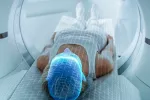 Encuentran daños en el centro de control del cerebro asociados al COVID Mujer en el interior de un escáner